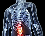 low back pain - Copyright â€“ Stock Photo / Register Mark