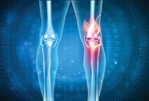 knee pain - Copyright – Stock Photo / Register Mark