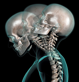 whiplash skeleton - Copyright – Stock Photo / Register Mark