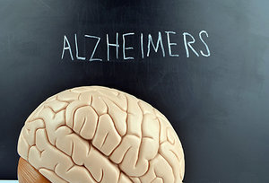 alzheimers - Copyright – Stock Photo / Register Mark