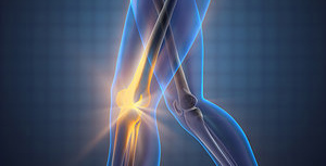 arthritis - Copyright – Stock Photo / Register Mark