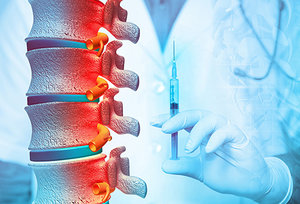 Bad for Spinal Pain - Copyright – Stock Photo / Register Mark