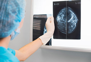breast cancer - Copyright – Stock Photo / Register Mark