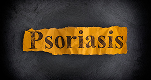 psoriasis - Copyright – Stock Photo / Register Mark