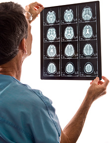 brain mri - Copyright – Stock Photo / Register Mark