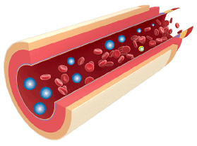 Abnormal Response (Diabetes) - Copyright – Stock Photo / Register Mark