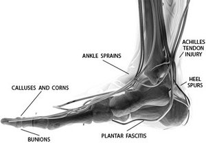 Illustration of the inner structure of the human foot and ankle. - Copyright – Stock Photo / Register Mark