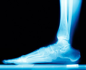 foot xray - Copyright – Stock Photo / Register Mark