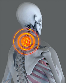 Neck pain 1 - Copyright – Stock Photo / Register Mark